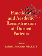 Functional and Aesthetic Reconstruction of Burned Patients2016 بازسازی عملکردی و زیبایی شناختی بیماران سوخته
