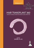 Hair Transplant 360 1st Edition2014 | کاشت مو 360