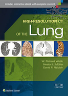 High-Resolution CT of the Lung Fifth Edition2014 سی تی ریه با وضوح بالا