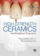 High-Strength Ceramics 1st Edition2014 سرامیک ها با مقاومت بالا