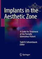 Implants in the Aesthetic Zone 1st Edition2018 | کاشت در منطقه زیبایی