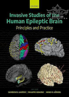 Invasive Studies of the Human Epileptic Brain2019 مطالعات تهاجمی مغز صرعی انسان