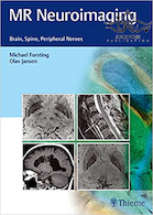 MR Neuroimaging: Brain, Spine, and Peripheral Nerves 1st Edition207 تصویربرداری عصبی MR: مغز ، ستون فقرات و اعصاب محیطی