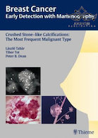 Breast Cancer: Early Detection with Mammography: Crushed Stone-like Calcifications: The Most Frequent Malignant Type 1st Edicion 2008 | سرطان سینه: تشخیص زودهنگام با ماموگرافی:
