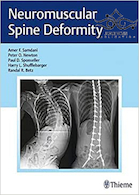Neuromuscular Spine Deformity 1st Edition2018 تغییر شکل عضله عصبی عضلانی