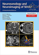 Neurosonology and Neuroimaging of Stroke, 2nd Edition2017 عصب شناسی و تصویربرداری عصبی از سکته مغزی