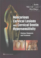 Noncarious Cervical Lesions and Cervical Dentin Hypersensitivity2017 ضایعات غیر سرطانی دهانه رحم و افزایش حساسیت عاج گردنی