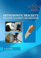 Orthodontic Brackets: Selection,Placement and Debonding2015 براکت های ارتودنسی: انتخاب ، جاگذاری و رد کردن
