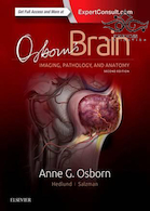 Osborn’s Brain, 2nd Edition2017 | ملزومات مغز آزبورن