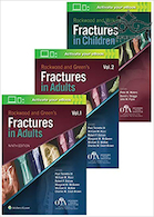 Rockwood and Green's Fractures in Adults 2019 | ارتوپدی و شکستگی راکوود ویرایش 9