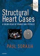 کتاب موارد قلبی ساختاری: اطلس رنگی مرواریدها و گودالها Structural Heart Cases: A Color Atlas of Pearls and Pitfalls 1st Edition 2019