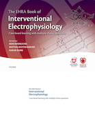 The EHRA Book of Interventional Electrophysiology : Case-based learning with multiple choice questions 2017 کتاب الکتروفیزیولوژی مداخله ای ERA: یادگیری مبتنی بر مورد با سوالات چند گزینه ای