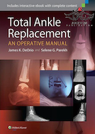 Total Ankle Replacement: An Operative Manual First Edition2014 تعویض کامل مچ پا: یک کتابچه راهنمای عملیاتی
