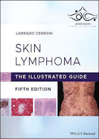 Skin Lymphoma: The Illustrated Guide 5th Edition 2020