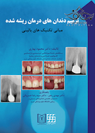 ترمیم دندان های درمان ریشه شده مبانی تکنیک های بالینی