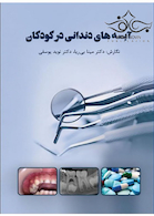 آبسه های دندانی در کودکان