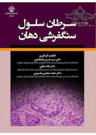 سرطان سلول سنگفرشی دهان