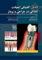 اصول کلینیکی ایمپلنت دندانی در جراحی و پروتز