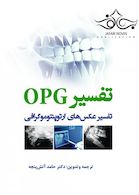 تفسیر OPG تفسیر عکس های ارتوپنتوموگرافی