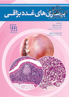 بیماری های غدد بزاقی