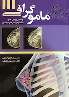 ماموگرافی وسایر روش های تشخیص سرطان پستان