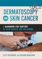 Dermatoscopy and Skin Cancer : A handbook for hunters of skin cancer and melanoma 2019 درماتوسکوپی و سرطان پوست: کتاب راهنما سرطان پوست