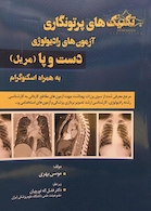 تکنیک های پرتونگاری آزمون های رادیولوژی دست و پا (مریل) به همراه اسکنوگرام (رنگی)