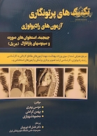 تکنیک های پرتونگاری آزمون های رادیولوژی جمجمه،استخوان های صورت و سینوسهای پارانازال (مریل)