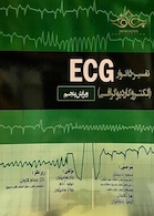 تفسیر 150نوار ECG (الکتروکاردیوگرافی)