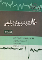 150 الکتروکاردیوگرام بالینی