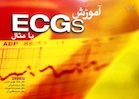 آموزش ECGs با مثال
