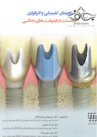 راهنمای کلینیکی و لابراتواری اباتمنت در ایمپلنت های دندانی