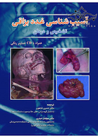 آسیب شناسی غدد بزاقی تشخیص و درمان