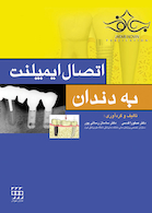 اتصال ایمپلنت به دندان