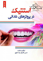 استتیک در پروتزهای دندانی