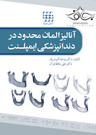 آنالیز المان محدود در دندانپزشکی ایمپلنت