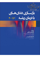 بازسازی دندان های با درمان ریشه 2016
