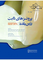 پروتزهای ثابت رزین و باندد 2018