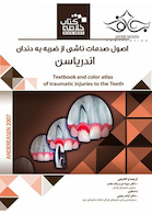 book brief خلاصه اصول صدمات ناشی از ضربه به دندان اندریاسن