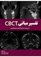 تفسیر مبانی CBCT