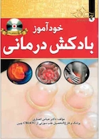 خود آزموز بادکش درمانی