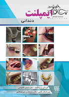 خودآموز ایمپلنت دندانی