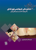 دندانپزشکی کم تهاجمی فوق لثه ای یک رویکرد سالم تر در ترمیم های زیبایی