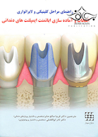 راهنمای مراحل کلینیکی و لابراتواری انتخاب و آماده سازی اباتمنت ایمپلنت های دندانی