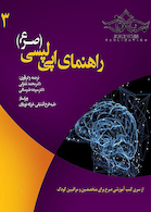 راهنمای اپی لپسی صرع