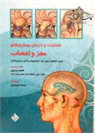 شناخت و درمان بیماری های مغز و اعصاب