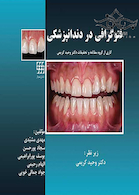 فتوگرافی در دندانپزشکی