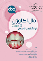 مال اکلوژن Class II؛ از تشخیص تا درمان