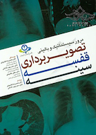 مروری سیستماتیک و بالینی تصویربرداری قفسه سینه