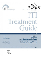 مشکلات بیولوژیک و سخت افزاری در دندانپزشکی ایمپلنت  ITI